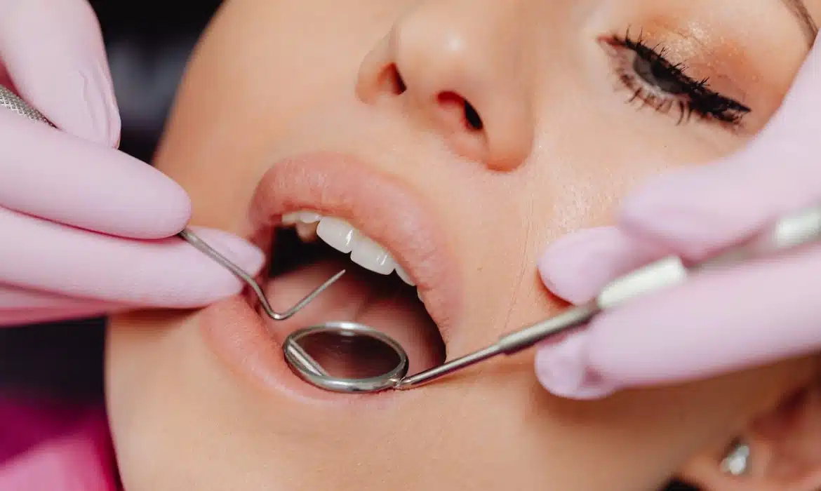 Tout ce que vous devez savoir sur les tenons dentaires et leur utilité dans les restaurations dentaires