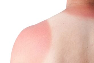 Vêtements protecteurs contre les effets nocifs du soleil sur la peau