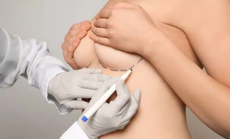Les différentes chirurgies mammaires
